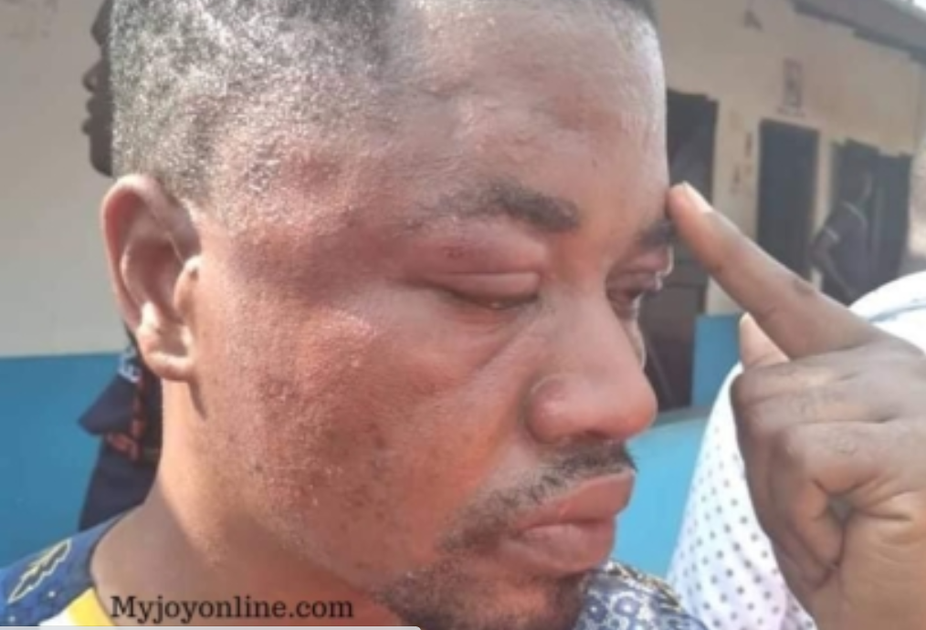 NPP’s Communications team member given 40 lashes (Credit: Myjoyonline)