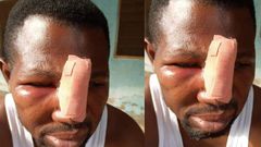 JHS student and his gang assault teacher at Nungua over homework