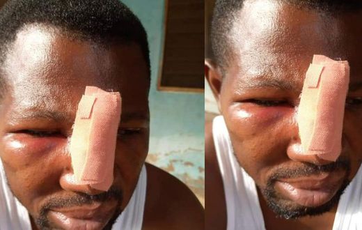 JHS student and his gang assault teacher at Nungua over homework