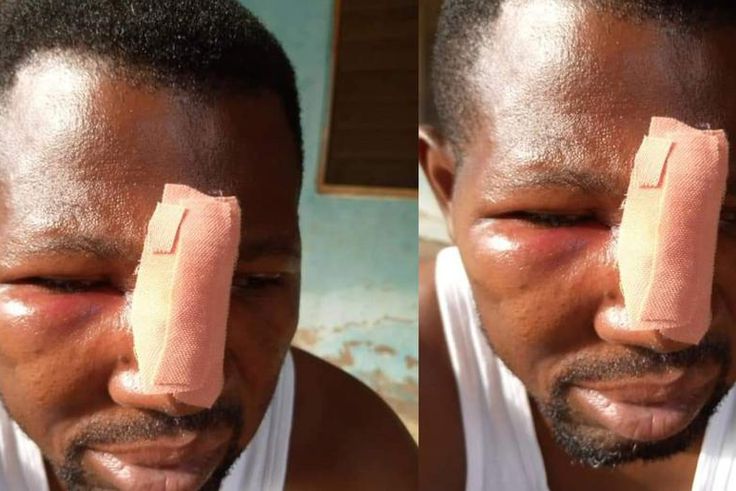 JHS student and his gang assault teacher at Nungua over homework