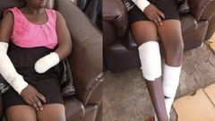 "He ordered me to undress & I refused” - Student, 16 narrates how rapist cut off her hand