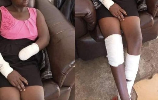 "He ordered me to undress & I refused” - Student, 16 narrates how rapist cut off her hand