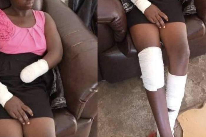 "He ordered me to undress & I refused” - Student, 16 narrates how rapist cut off her hand