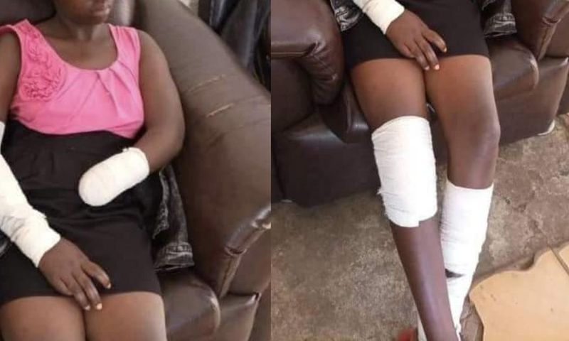 "He ordered me to undress & I refused” - Student, 16 narrates how rapist cut off her hand