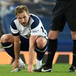 Double trouble - Harry Kane scored twice for Tottenham in a 2-2 draw away to Everton but left the field injured before full-time at Goodison Park