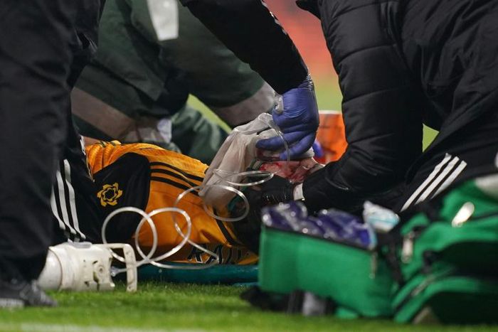 Wolverhampton Wanderers' Mexican striker Raul Jimenez  fractured his skull in a horrific clash of heads with Arsenal's David Luiz