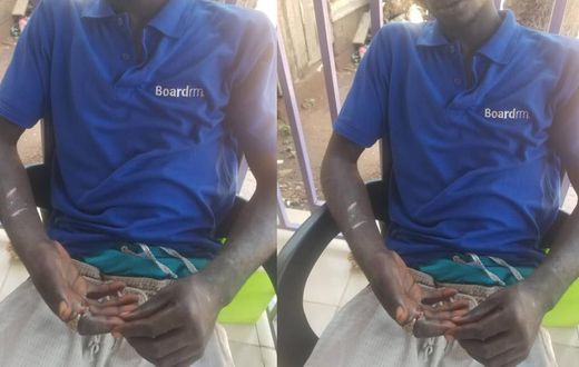 Pantang teenager's index finger rots away after wearing stolen ‘spiritual’ ring