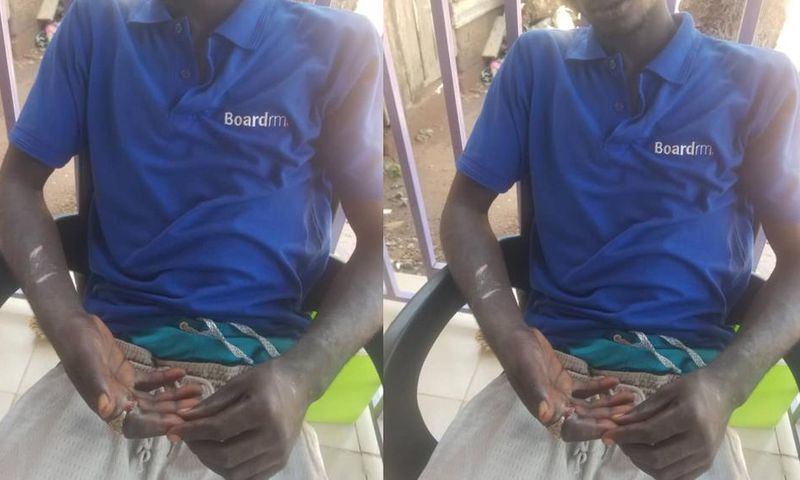 Pantang teenager's index finger rots away after wearing stolen ‘spiritual’ ring