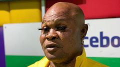 Bukom Banku bleaching again