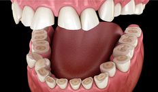 Here are 6 possible reasons why your tooth aches after drinking chilled water