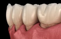 Here are 6 possible reasons why your tooth aches after drinking chilled water