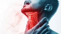 Throat cancer