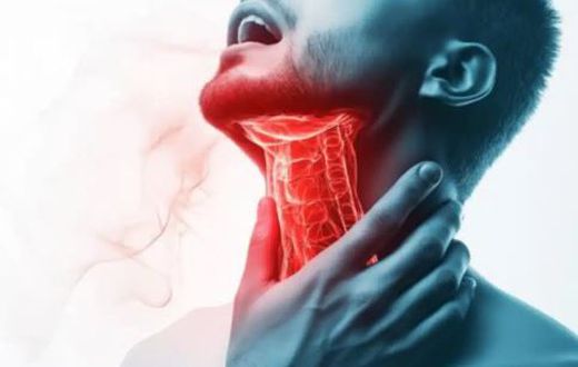 Throat cancer