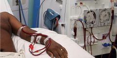 There is no free kidney dialysis anywhere - Health Minister