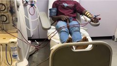 Gov’t to extend dialysis treatment subsidy to private hospitals – Akandoh