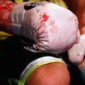 Boxing banned in Ghana after deaths of two boxers in seven months