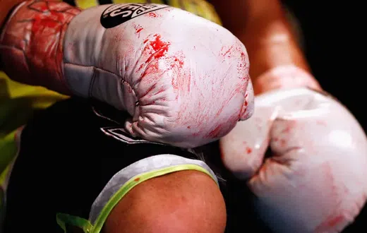 Boxing banned in Ghana after deaths of two boxers in seven months