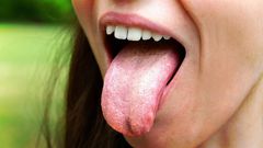 4 symptoms of candida overgrowth and how to treat it