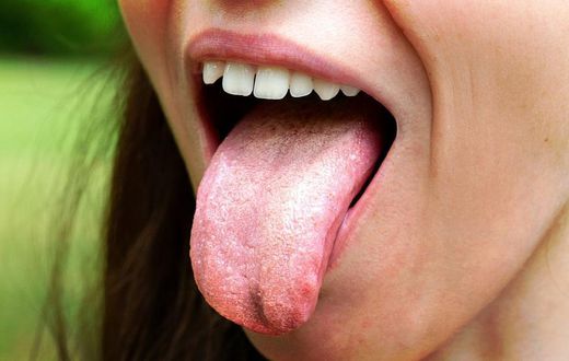 4 symptoms of candida overgrowth and how to treat it