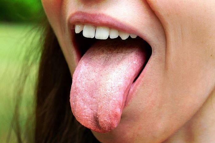 4 symptoms of candida overgrowth and how to treat it