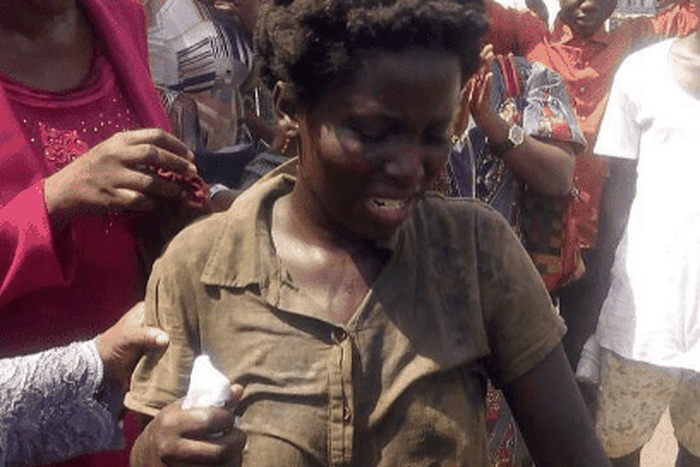 Mentally challenged woman