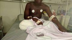 16-year-old boy leg amputated