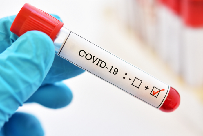 COVID-19 positive test