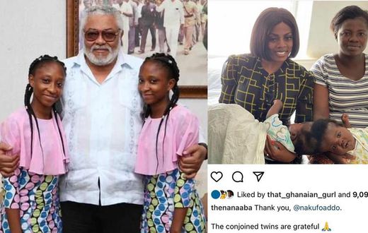 1st conjoined twins separated in Ghana, Lydia and Linda meet J.J Rawlings