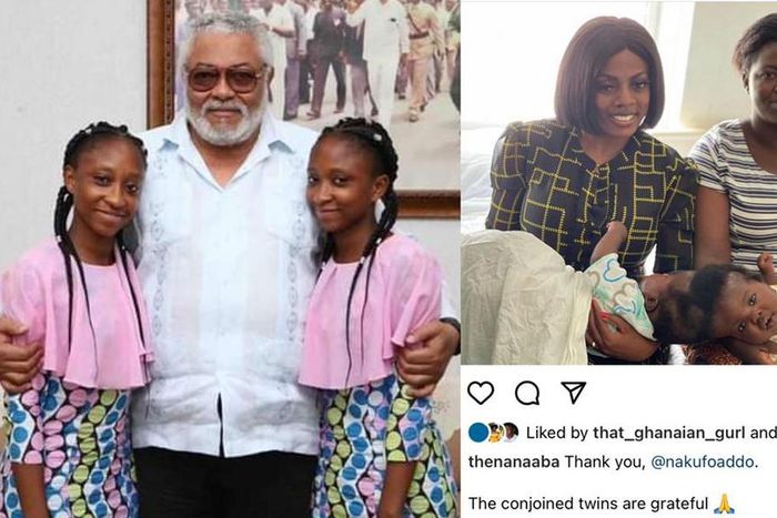 1st conjoined twins separated in Ghana, Lydia and Linda meet J.J Rawlings
