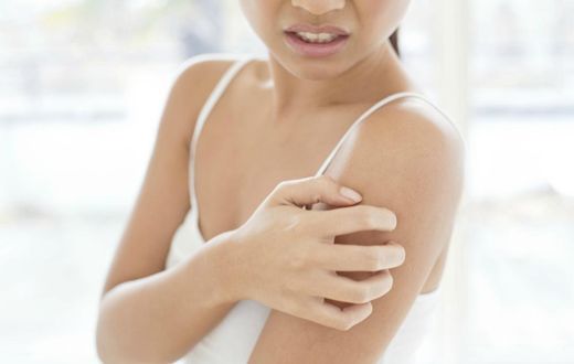 Ringworm: 5 home remedies for this skin infection