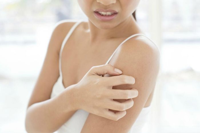 Ringworm: 5 home remedies for this skin infection
