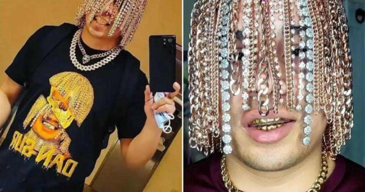 Rapper gets gold chains surgically implanted on his head for new look ...