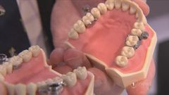 Weight loss device that locks your teeth to stop you from chewing until you become slim