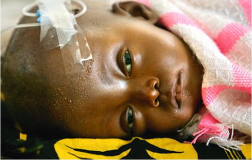 Cerebral Malaria: Seek help timely to avoid Neurocognitive Sequelae