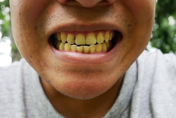 5 effective ways to get rid of yellow teeth