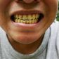 5 effective ways to get rid of yellow teeth