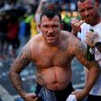 An England fan, injured by a flying bottle, poses for a photograph on the edge of Trafalgar Square during a live screening of the UEFA EURO 2020 final