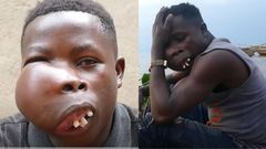 “I feel jealous when I see people’s faces” – Noah, 19-year-old orphan