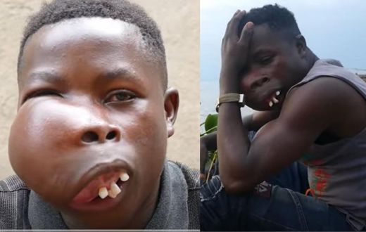 “I feel jealous when I see people’s faces” – Noah, 19-year-old orphan