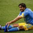 Philadelphia Union captain Alejandro Bedoya was among 11 players who were listed as out on Saturday due to Covid-19 health and safety protocols for the club ahead of its MLS semi-final on Sunday against New York City FC