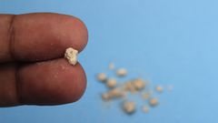 What are kidney stones?