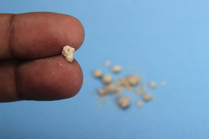 What are kidney stones?