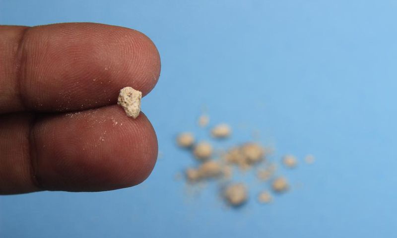 What are kidney stones?
