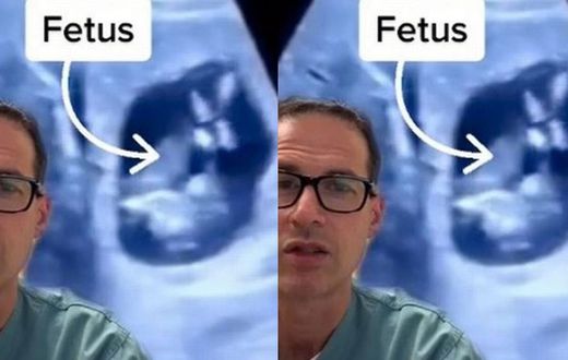 Doctors find baby inside woman’s liver instead of the womb