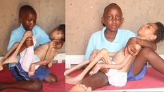 Help my twin brother get treatment – 12-year-old girl (video)