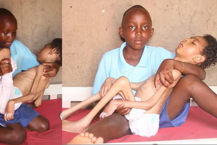 Help my twin brother get treatment – 12-year-old girl (video)