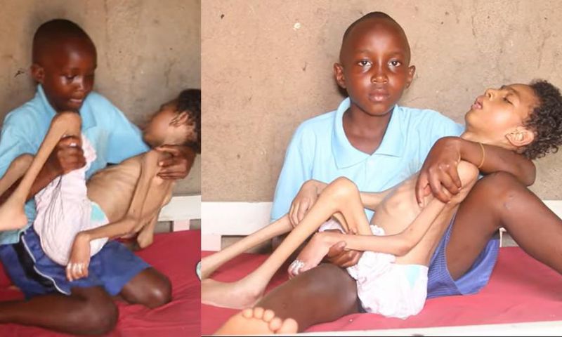 Help my twin brother get treatment – 12-year-old girl (video)