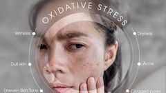 5 Ways Stress Ages Your Skin (and What to Do About It)