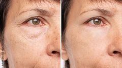 5 Ways Stress Ages Your Skin (and What to Do About It)