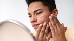 5 Ways Stress Ages Your Skin (and What to Do About It)